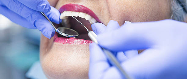 Best Emergency Dental Care for Sports Injuries in Valley Forge, TN